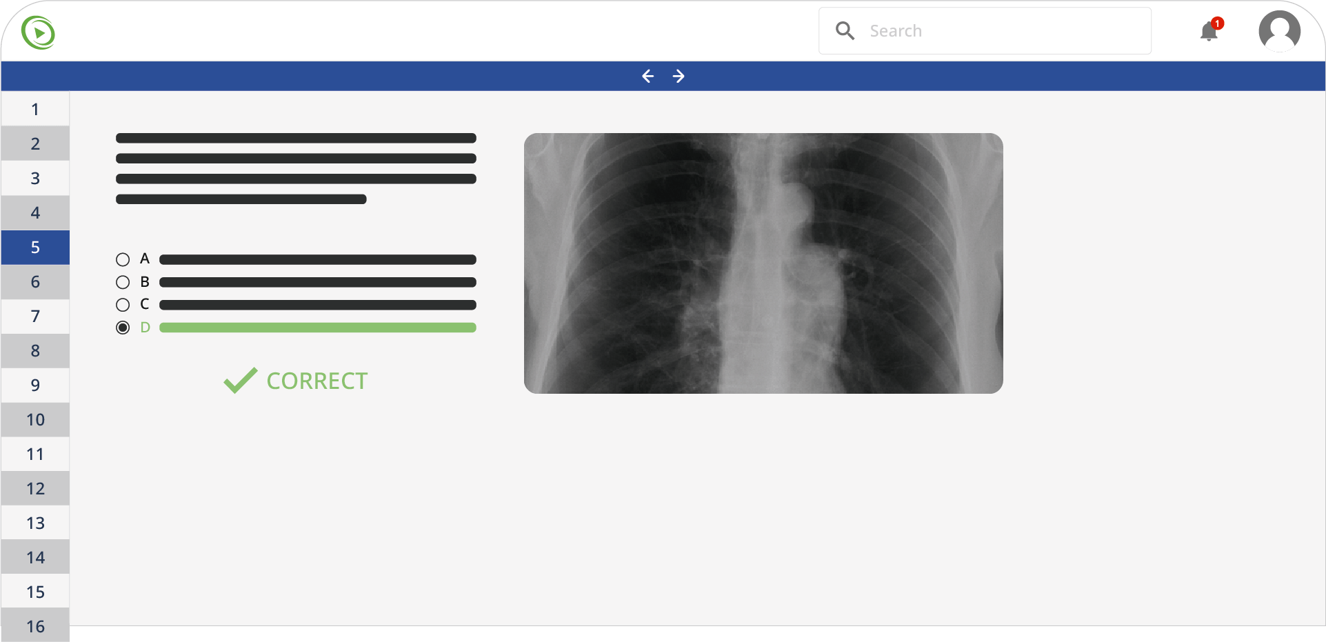 Usmle step 1 composition platform showing correct chest x-ray diagnosis.